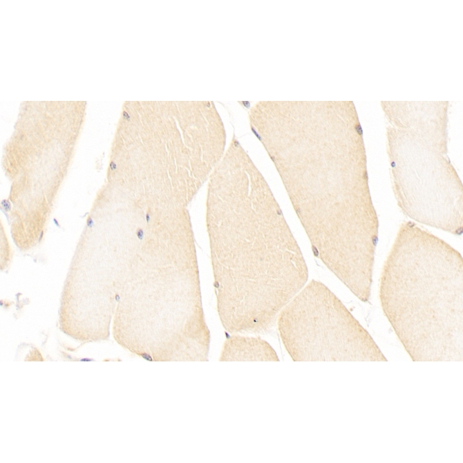Immunoglobulin Superfamily Containing Leucine Rich Repeat Protein (ISLR) Human Monoclonal Antibody