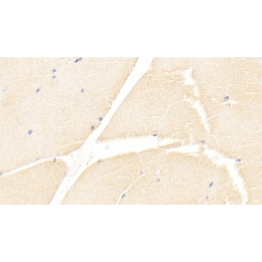 Immunoglobulin Superfamily Containing Leucine Rich Repeat Protein (ISLR) Human Monoclonal Antibody