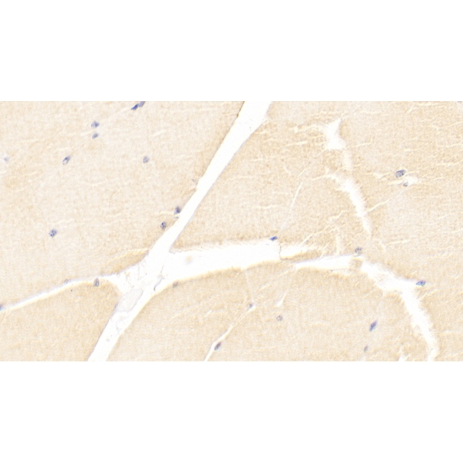 Immunoglobulin Superfamily Containing Leucine Rich Repeat Protein (ISLR) Human Monoclonal Antibody