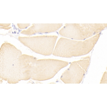 Immunoglobulin Superfamily Containing Leucine Rich Repeat Protein (ISLR) Human Monoclonal Antibody