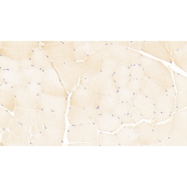 Immunoglobulin Superfamily Containing Leucine Rich Repeat Protein (ISLR) Human Monoclonal Antibody