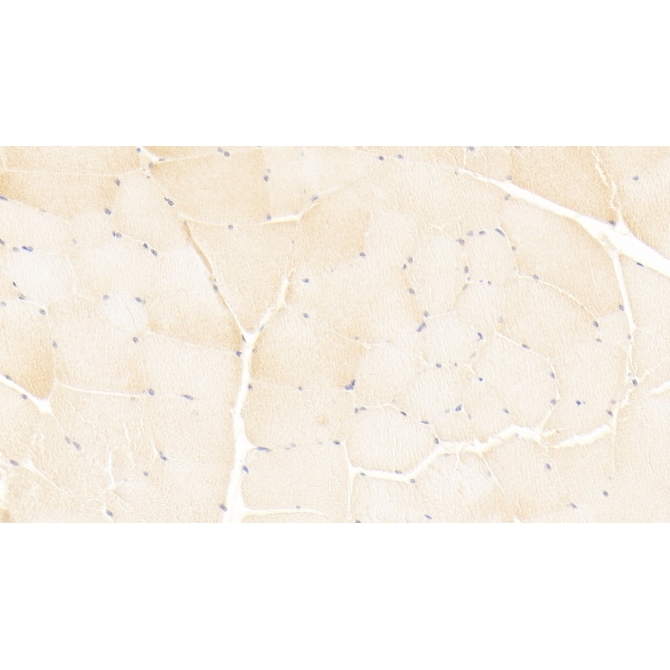 Immunoglobulin Superfamily Containing Leucine Rich Repeat Protein (ISLR) Human Monoclonal Antibody