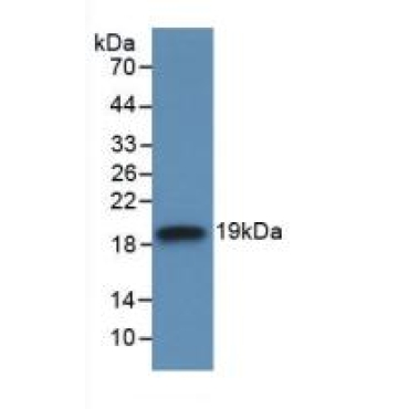 Interleukin 18 Binding Protein (IL18BP) Human Monoclonal Antibody