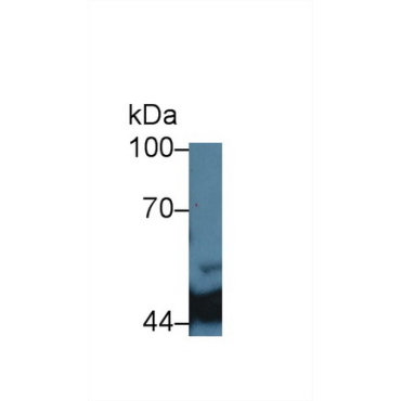 Isocitrate Dehydrogenase 1, Soluble (IDH1) Human Monoclonal Antibody