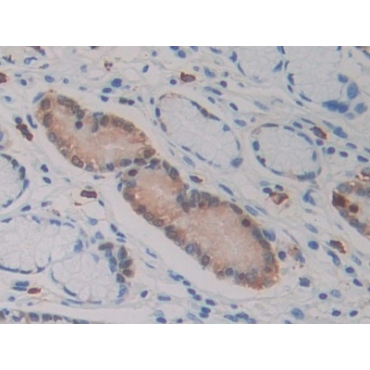 Isocitrate Dehydrogenase 1, Soluble (IDH1) Human Monoclonal Antibody