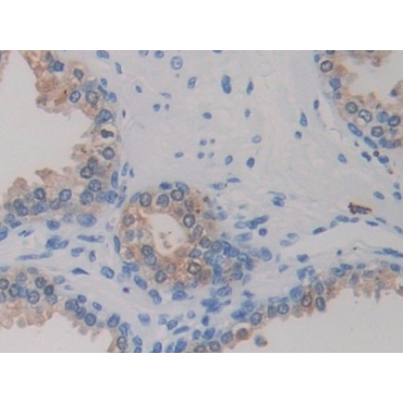 Isocitrate Dehydrogenase 1, Soluble (IDH1) Human Monoclonal Antibody