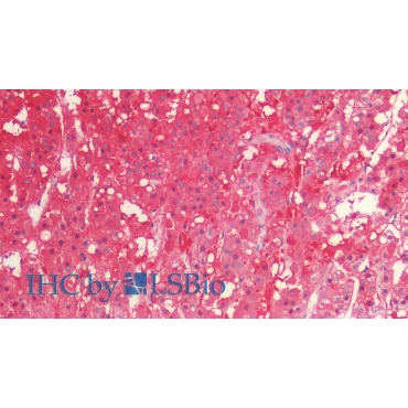 Isocitrate Dehydrogenase 1, Soluble (IDH1) Human Monoclonal Antibody