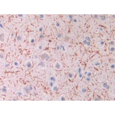 Isocitrate Dehydrogenase 1, Soluble (IDH1) Human Monoclonal Antibody