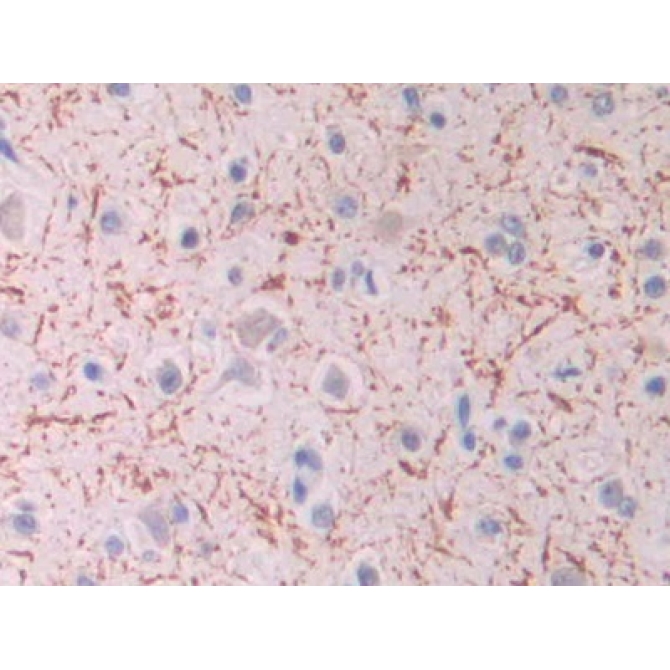 Isocitrate Dehydrogenase 1, Soluble (IDH1) Human Monoclonal Antibody