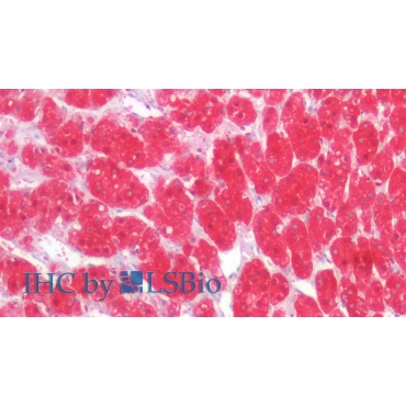 Isocitrate Dehydrogenase 1, Soluble (IDH1) Human Monoclonal Antibody