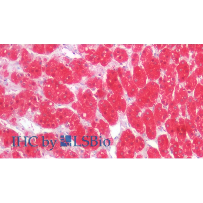 Isocitrate Dehydrogenase 1, Soluble (IDH1) Human Monoclonal Antibody