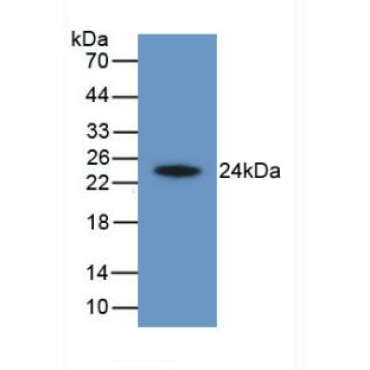 Hepatitis A Virus Cellular Receptor 2 (HAVCR2) Human Monoclonal Antibody