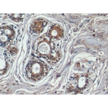 Hepatitis A Virus Cellular Receptor 2 (HAVCR2) Human Monoclonal Antibody