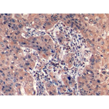 Hepatitis A Virus Cellular Receptor 2 (HAVCR2) Human Monoclonal Antibody