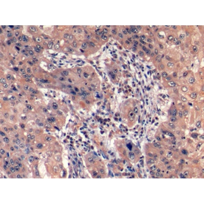 Hepatitis A Virus Cellular Receptor 2 (HAVCR2) Human Monoclonal Antibody