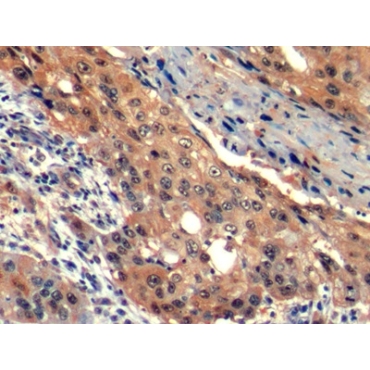 Hepatitis A Virus Cellular Receptor 2 (HAVCR2) Human Monoclonal Antibody