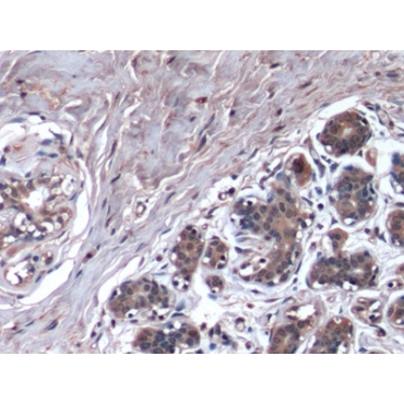 Hepatitis A Virus Cellular Receptor 2 (HAVCR2) Human Monoclonal Antibody