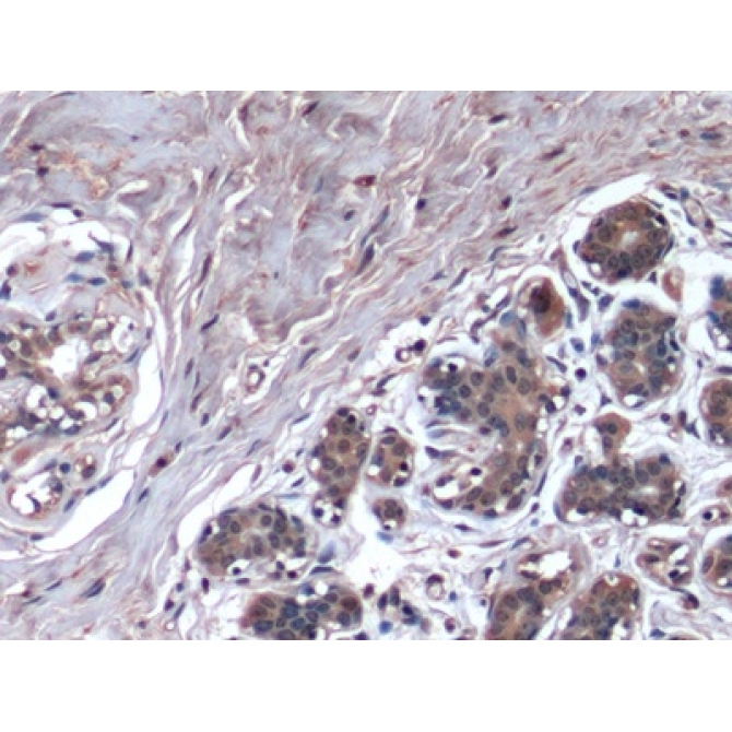 Hepatitis A Virus Cellular Receptor 2 (HAVCR2) Human Monoclonal Antibody