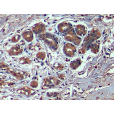 Hepatitis A Virus Cellular Receptor 2 (HAVCR2) Human Monoclonal Antibody
