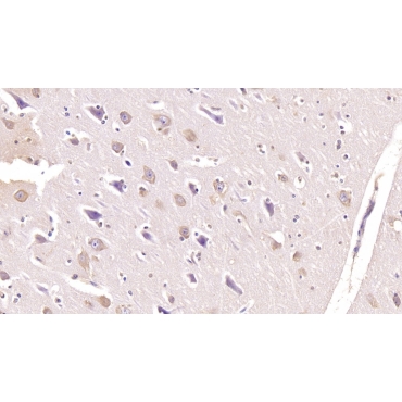 Follistatin Like Protein 1 (FSTL1) Human Monoclonal Antibody