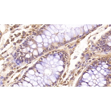 Follistatin Like Protein 1 (FSTL1) Human Monoclonal Antibody
