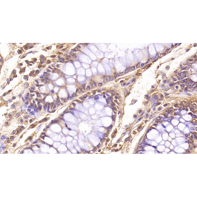 Follistatin Like Protein 1 (FSTL1) Human Monoclonal Antibody