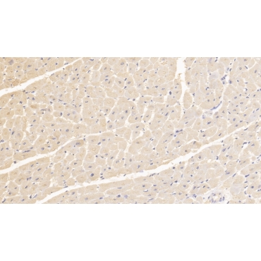 Fission 1 (FIS1) Human Monoclonal Antibody