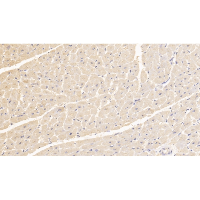 Fission 1 (FIS1) Human Monoclonal Antibody