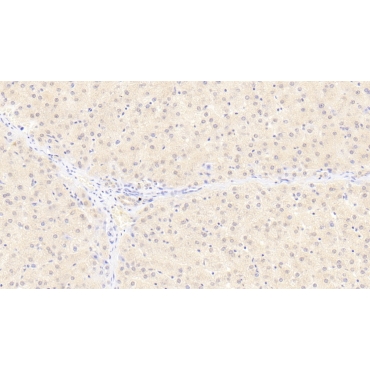 Fission 1 (FIS1) Human Monoclonal Antibody