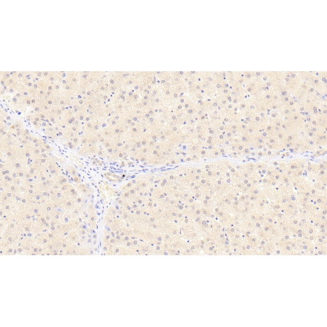 Fission 1 (FIS1) Human Monoclonal Antibody