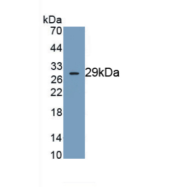 Dynein, Axonemal, Heavy Chain 11 (DNAH11) Human Monoclonal Antibody