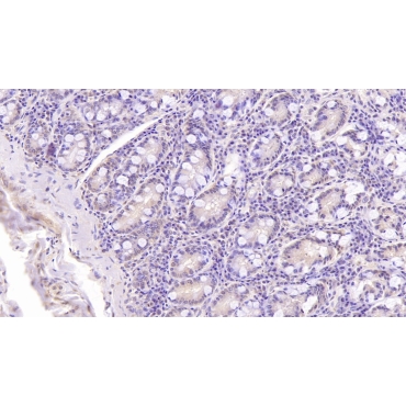 Dynein, Axonemal, Heavy Chain 11 (DNAH11) Human Monoclonal Antibody