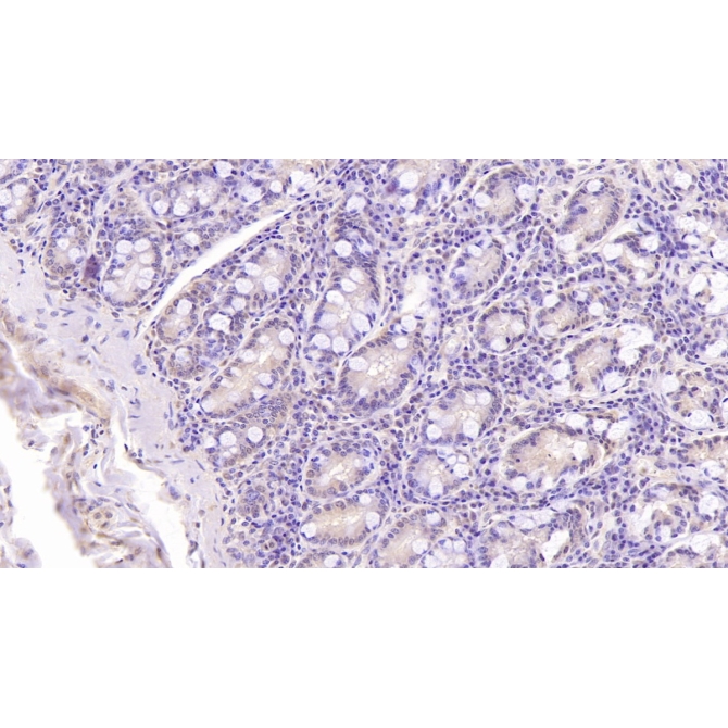 Dynein, Axonemal, Heavy Chain 11 (DNAH11) Human Monoclonal Antibody