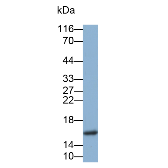Cystatin 2 (CST2) Human Monoclonal Antibody