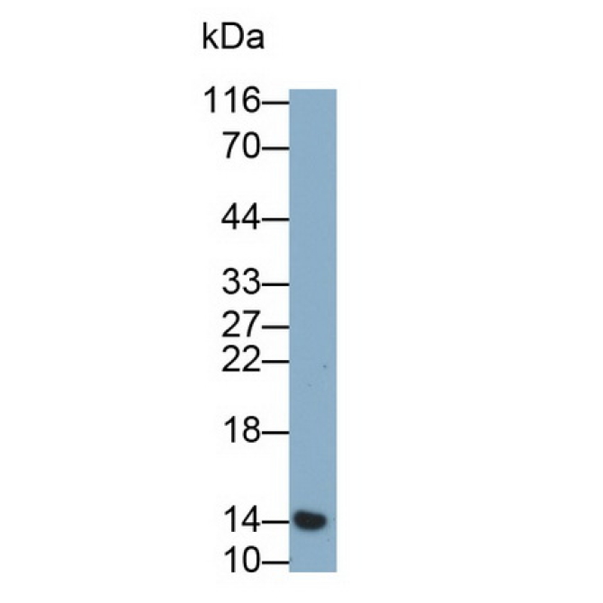Cystatin 4 (CST4) Human Monoclonal Antibody