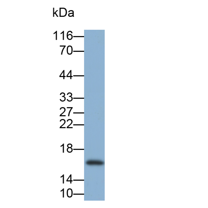 Cystatin 1 (CST1) Human Monoclonal Antibody