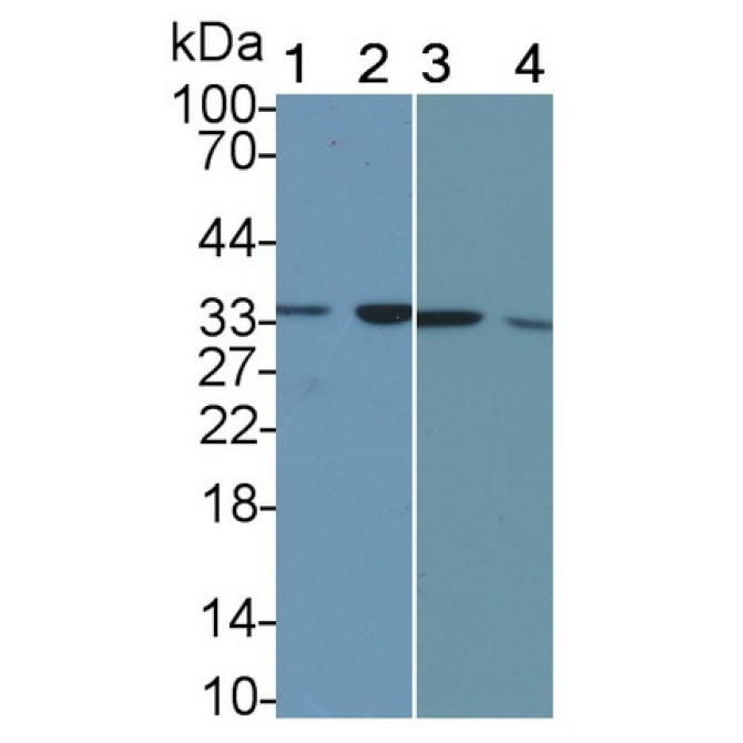 Calponin 2 (CNN2) Human Monoclonal Antibody