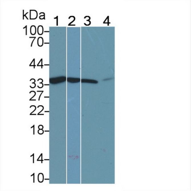 Calponin 2 (CNN2) Human Monoclonal Antibody