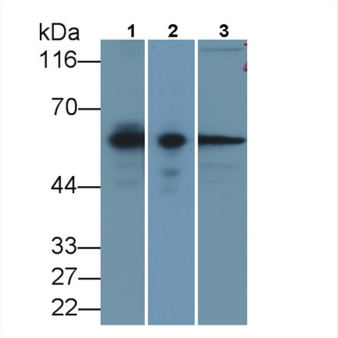 Calponin 2 (CNN2) Human Monoclonal Antibody