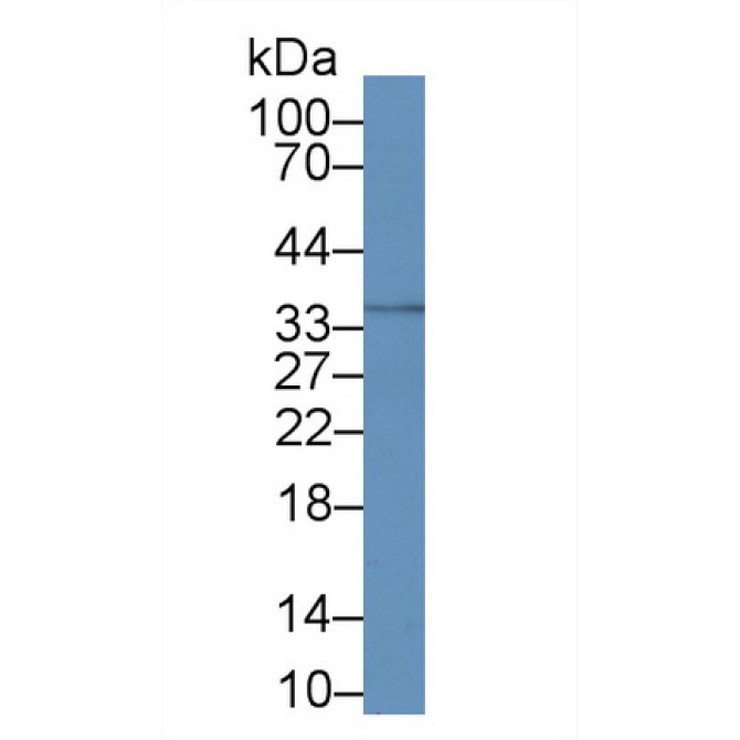 Calponin 2 (CNN2) Human Monoclonal Antibody