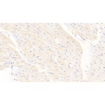 Calponin 2 (CNN2) Human Monoclonal Antibody