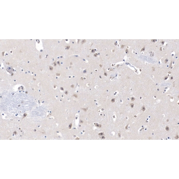 Lecithin Cholesterol Acyltransferase (LCAT) Human Monoclonal Antibody