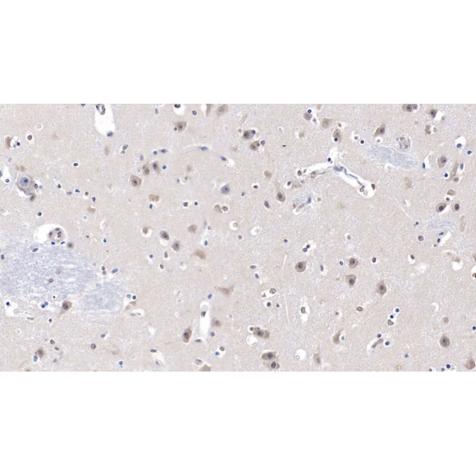 Lecithin Cholesterol Acyltransferase (LCAT) Human Monoclonal Antibody