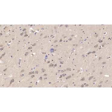 Lecithin Cholesterol Acyltransferase (LCAT) Human Monoclonal Antibody