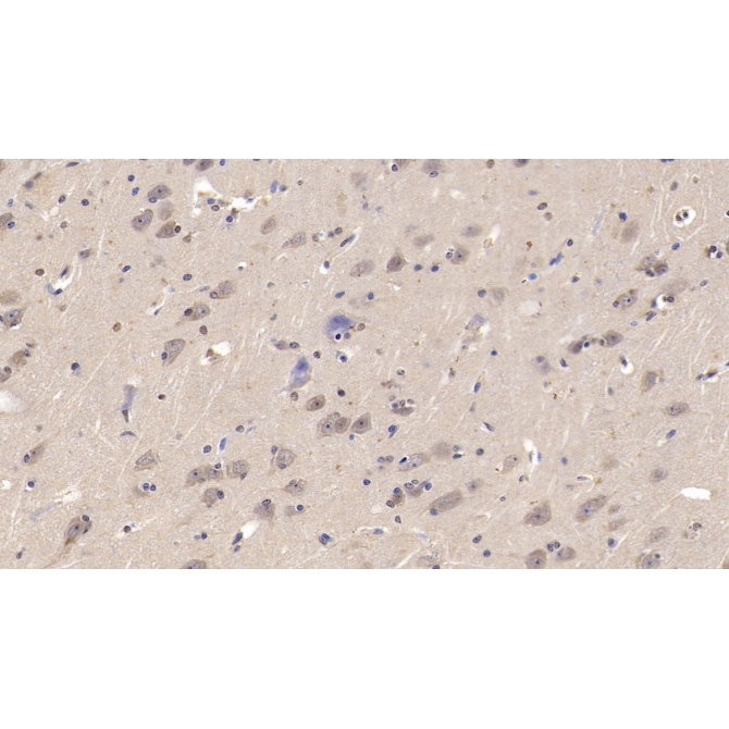 Lecithin Cholesterol Acyltransferase (LCAT) Human Monoclonal Antibody
