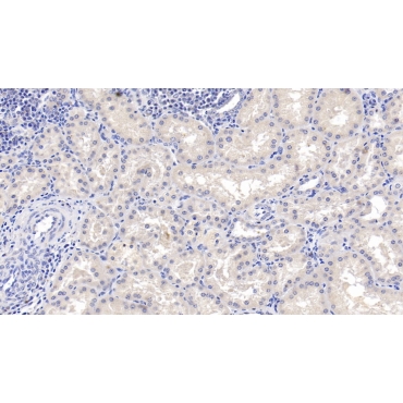 Lecithin Cholesterol Acyltransferase (LCAT) Human Monoclonal Antibody