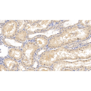 Lecithin Cholesterol Acyltransferase (LCAT) Human Monoclonal Antibody