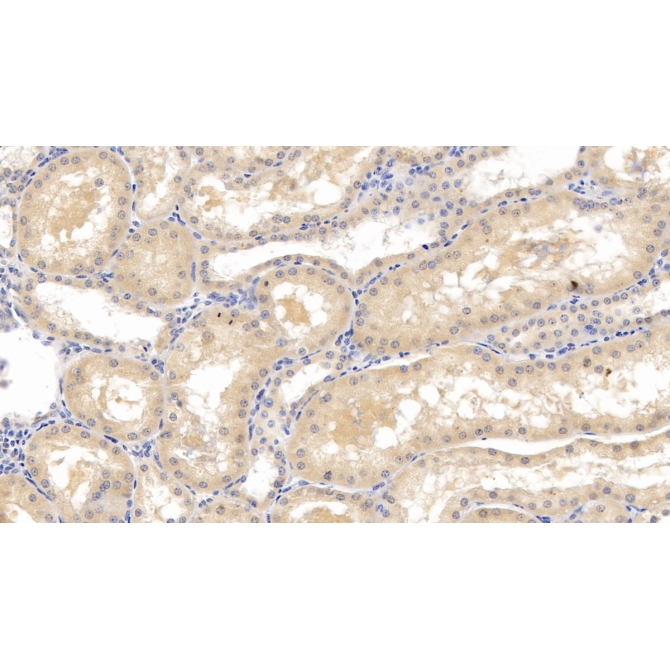Lecithin Cholesterol Acyltransferase (LCAT) Human Monoclonal Antibody