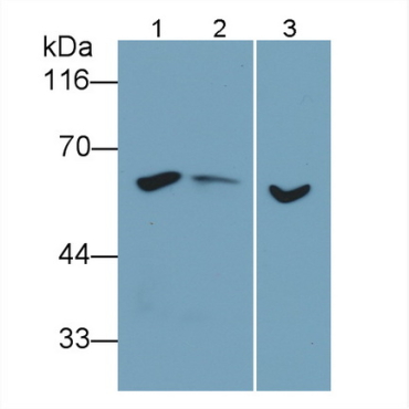 Beclin 1 (BECN1) Human Monoclonal Antibody