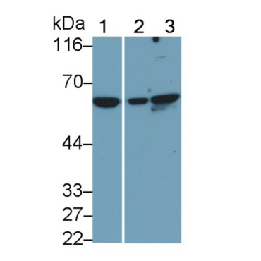 Beclin 1 (BECN1) Human Monoclonal Antibody